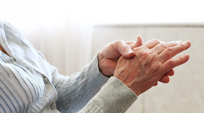 Understanding Arthritis