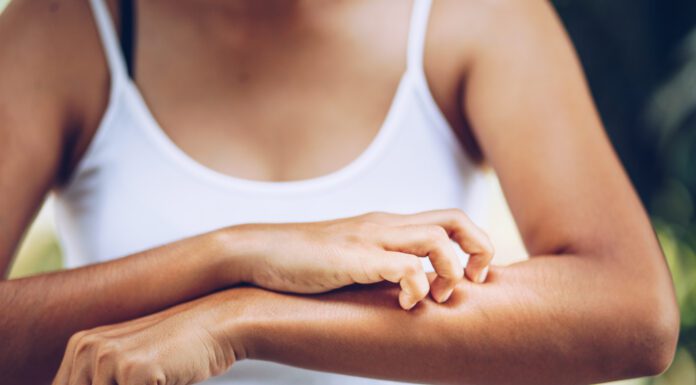 Protecting Our Largest Organ